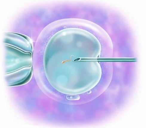 显微操作